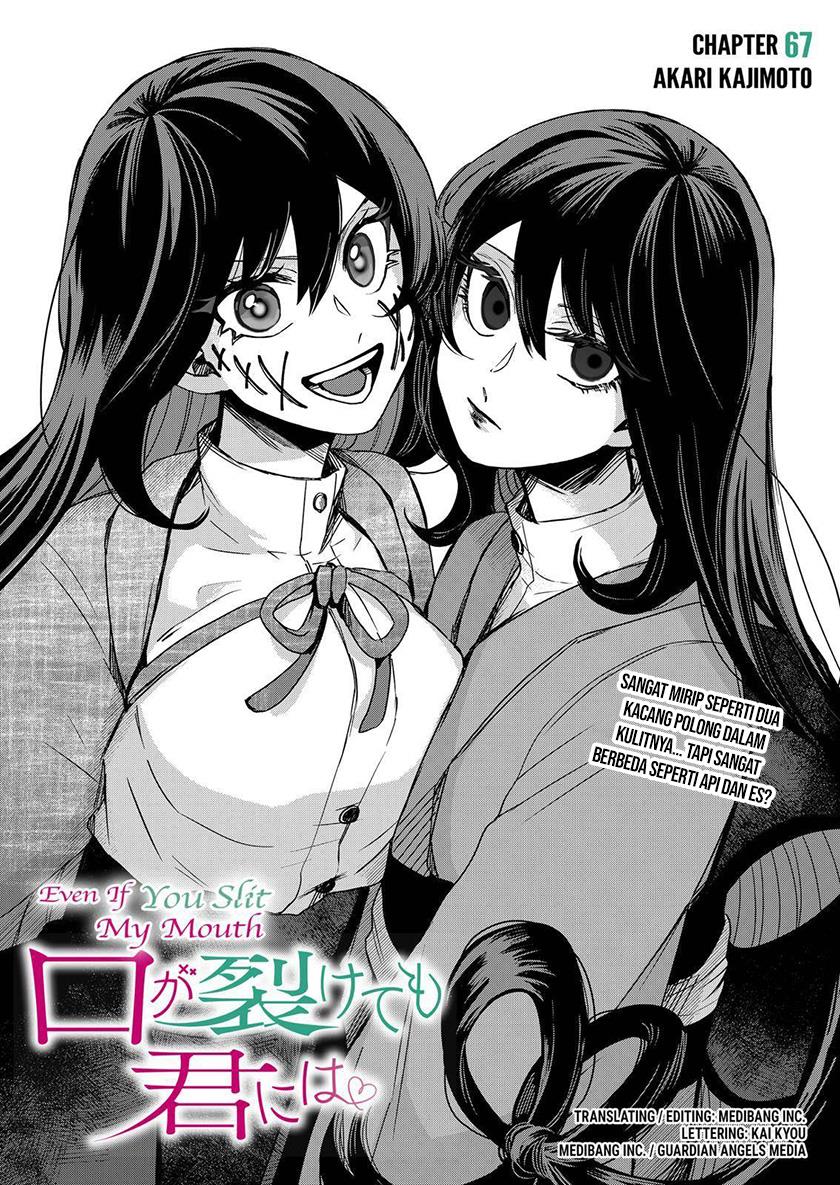 Kuchi ga Saketemo Kimi ni wa Chapter 67